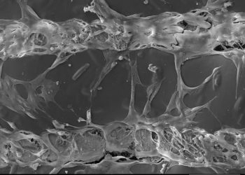 Учени разработват нови материали  за ортопедични импланти