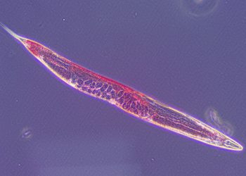 Затлъстяването е сериозна пандемия