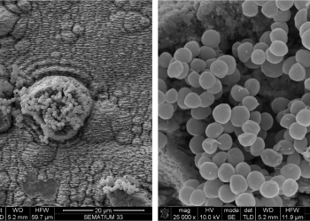 Антибактериални материали за медицински импланти