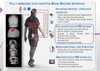 Невропротези ще позволят на пациенти да проходят